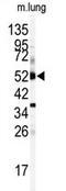 Cytochrome P450 Family 1 Subfamily A Member 1 antibody, AP14898PU-N, Origene, Western Blot image 