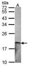 Endothelin 2 antibody, PA5-34679, Invitrogen Antibodies, Western Blot image 