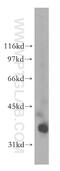 PDZ And LIM Domain 3 antibody, 13199-2-AP, Proteintech Group, Western Blot image 