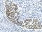 KRT18 antibody, M01357-4, Boster Biological Technology, Immunohistochemistry paraffin image 