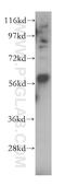 Lysophosphatidylcholine Acyltransferase 4 antibody, 17905-1-AP, Proteintech Group, Western Blot image 