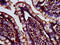 Cerebellar Degeneration Related Protein 2 Like antibody, CSB-PA005104LA01HU, Cusabio, Immunohistochemistry paraffin image 