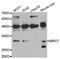 Baculoviral IAP Repeat Containing 7 antibody, A5736, ABclonal Technology, Western Blot image 