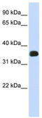 Matrix AAA Peptidase Interacting Protein 1 antibody, TA339364, Origene, Western Blot image 