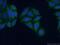 Kinesin Associated Protein 3 antibody, 12700-1-AP, Proteintech Group, Immunofluorescence image 
