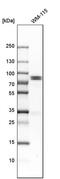 Holliday junction recognition protein antibody, PA5-52562, Invitrogen Antibodies, Western Blot image 