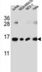 H2A Histone Family Member J antibody, abx032560, Abbexa, Western Blot image 