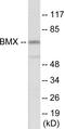 BMX Non-Receptor Tyrosine Kinase antibody, EKC1736, Boster Biological Technology, Western Blot image 