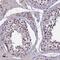 Ring Finger Protein 40 antibody, NBP1-88356, Novus Biologicals, Immunohistochemistry paraffin image 