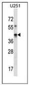 PDZ domain-containing protein GIPC1 antibody, AP51843PU-N, Origene, Western Blot image 