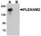 Pleckstrin Homology And RUN Domain Containing M2 antibody, A11280, Boster Biological Technology, Western Blot image 