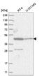 Zinc Finger Protein 586 antibody, NBP2-56434, Novus Biologicals, Western Blot image 