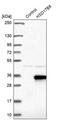 Hydroxysteroid 17-Beta Dehydrogenase 8 antibody, PA5-59882, Invitrogen Antibodies, Western Blot image 