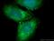 Phosphoglycerate Dehydrogenase antibody, 14719-1-AP, Proteintech Group, Immunofluorescence image 