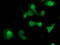 Suppressor Of Cytokine Signaling 3 antibody, TA502991, Origene, Immunofluorescence image 