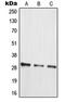 Mitochondrial Ribosomal Protein L10 antibody, LS-C353621, Lifespan Biosciences, Western Blot image 