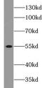 Complement C3a Receptor 1 antibody, FNab10502, FineTest, Western Blot image 