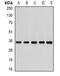 26S proteasome non-ATPase regulatory subunit 7 antibody, orb340900, Biorbyt, Western Blot image 