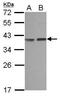 Carbonic Anhydrase 8 antibody, GTX107285, GeneTex, Western Blot image 