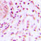 BRCA1 Associated RING Domain 1 antibody, GTX55221, GeneTex, Immunohistochemistry paraffin image 