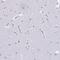 Eosinophil cationic-type ribonuclease 3 antibody, NBP2-33778, Novus Biologicals, Immunohistochemistry paraffin image 