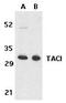 CD267 antibody, TA306064, Origene, Western Blot image 