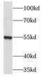 Phosphodiesterase 6C antibody, FNab06260, FineTest, Western Blot image 
