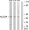 Aldolase, Fructose-Bisphosphate A antibody, TA313445, Origene, Western Blot image 