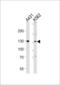 Polypeptide N-Acetylgalactosaminyltransferase 5 antibody, LS-C166357, Lifespan Biosciences, Western Blot image 