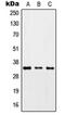 Zinc Finger CCCH-Type Containing 8 antibody, orb215323, Biorbyt, Western Blot image 