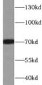 Transforming Growth Factor Beta Induced antibody, FNab08642, FineTest, Western Blot image 