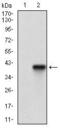 Acid Phosphatase 5, Tartrate Resistant antibody, GTX60778, GeneTex, Western Blot image 