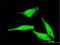 Cytosolic purine 5 -nucleotidase antibody, H00022978-M02, Novus Biologicals, Immunocytochemistry image 