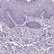 Adrenoceptor Beta 1 antibody, HPA067972, Atlas Antibodies, Immunohistochemistry paraffin image 