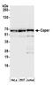 RNA Binding Motif Protein 39 antibody, A300-291A, Bethyl Labs, Western Blot image 