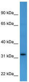 Docking Protein 4 antibody, TA342886, Origene, Western Blot image 