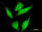 LIM Domain 7 antibody, LS-C197623, Lifespan Biosciences, Immunofluorescence image 