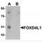 Forkhead Box D4 Like 1 antibody, MBS151002, MyBioSource, Western Blot image 