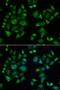Laforin antibody, LS-C334984, Lifespan Biosciences, Immunofluorescence image 