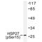 HSPB1 antibody, AP01607PU-N, Origene, Western Blot image 