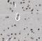 Protein Phosphatase 2 Regulatory Subunit B''Gamma antibody, FNab06721, FineTest, Immunohistochemistry frozen image 