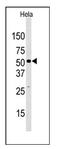 Lysine-specific demethylase 4D antibody, AP11041PU-N, Origene, Western Blot image 