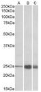 Troponin I2, Fast Skeletal Type antibody, AP32706PU-N, Origene, Western Blot image 