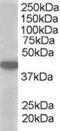 Monocarboxylate transporter 2 antibody, MBS421479, MyBioSource, Western Blot image 