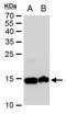 Histone Cluster 1 H2A Family Member M antibody, PA5-35893, Invitrogen Antibodies, Western Blot image 
