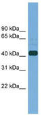 Plasminogen Activator, Tissue Type antibody, TA344649, Origene, Western Blot image 