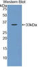 Acid Phosphatase 5, Tartrate Resistant antibody, LS-C292591, Lifespan Biosciences, Western Blot image 
