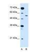 Solute Carrier Family 2 Member 10 antibody, NBP1-59688, Novus Biologicals, Western Blot image 