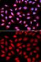 Protein Phosphatase 2 Phosphatase Activator antibody, GTX54592, GeneTex, Immunofluorescence image 