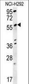 Spermatogenesis Associated 18 antibody, LS-C161427, Lifespan Biosciences, Western Blot image 